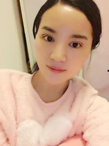 明星抽眼脂,抽眼脂術，揭秘眼部年輕化的秘密武器