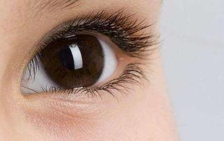 吃黃河蜜瓜眼睛模糊